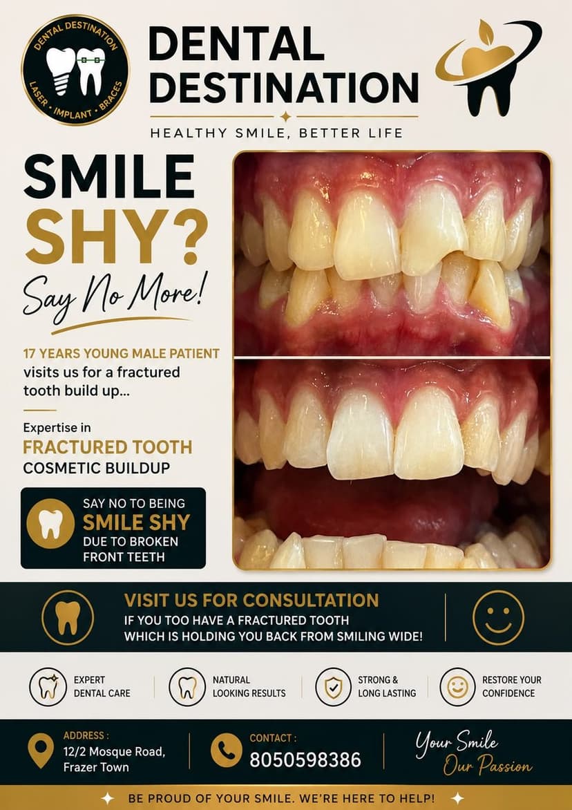 Smile Makeover