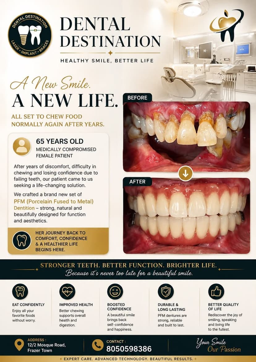 Full Mouth Rehabilitation