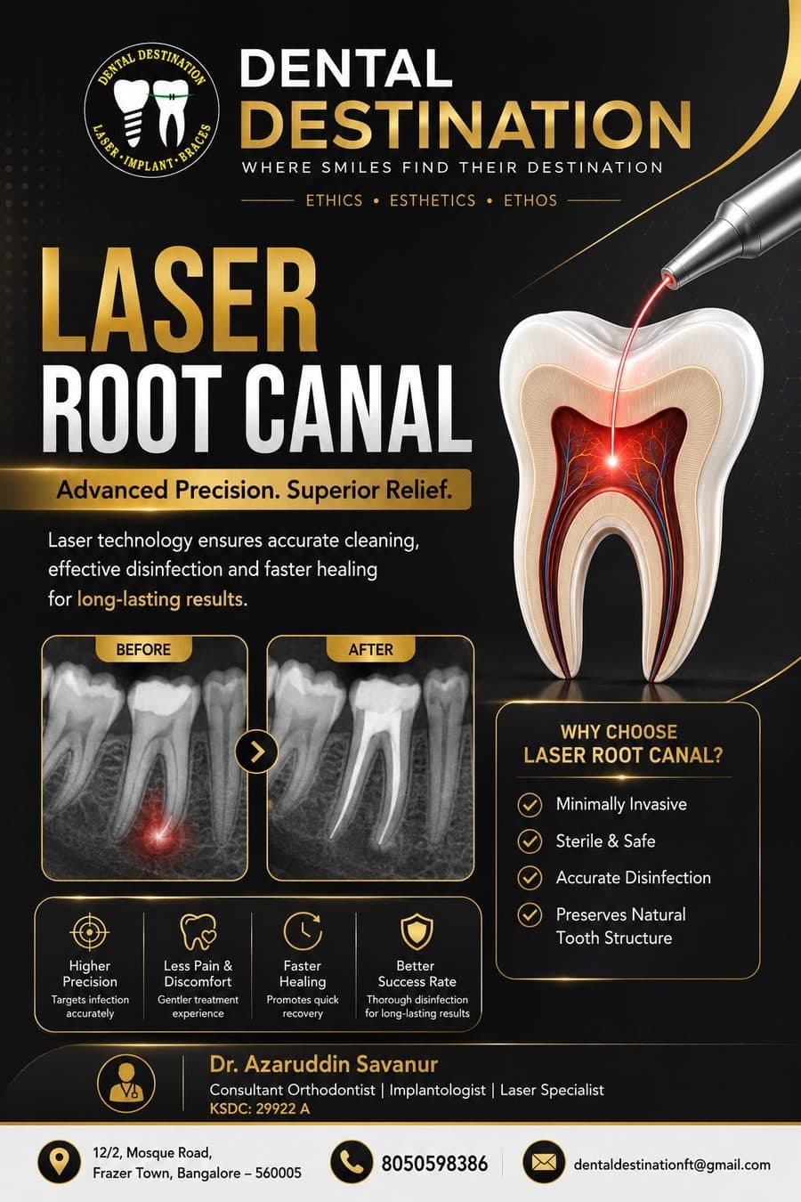 Laser Root Canal Treatment