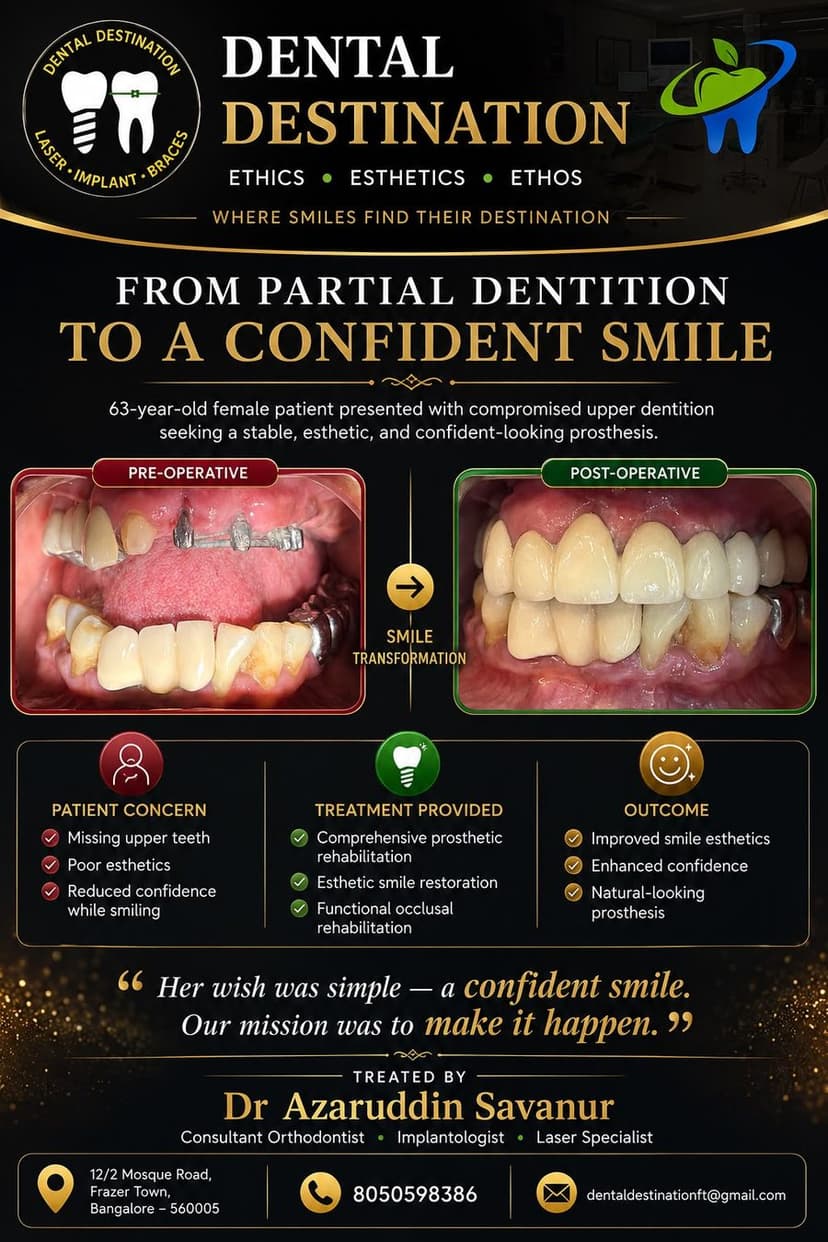 Dental Implants