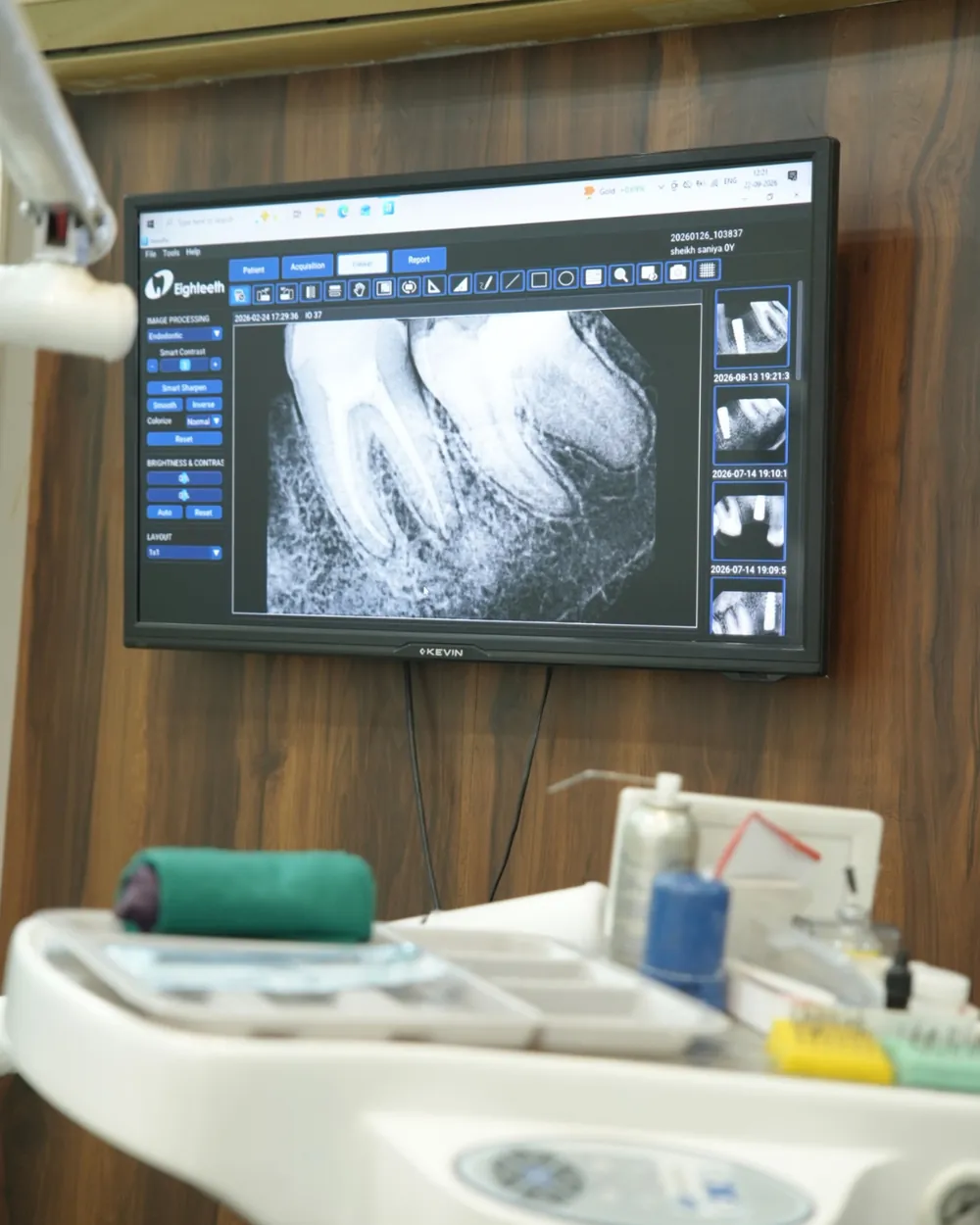 Digital dental X-ray displayed chairside at Dental Destination