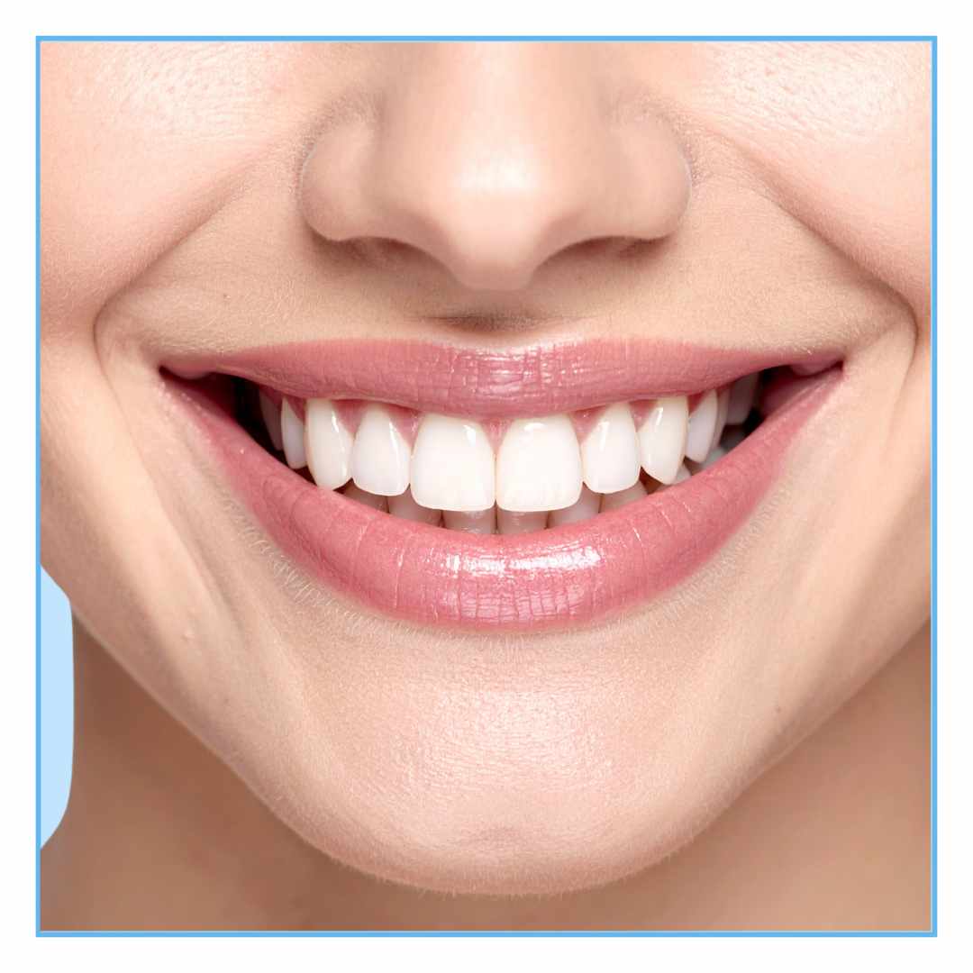 Hollywood Smile in Frazer Town