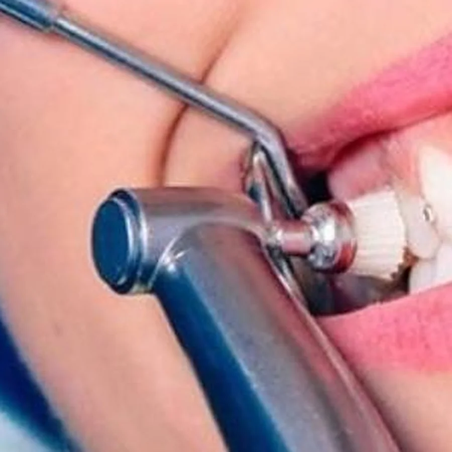 Laser Pain Management in Frazer Town