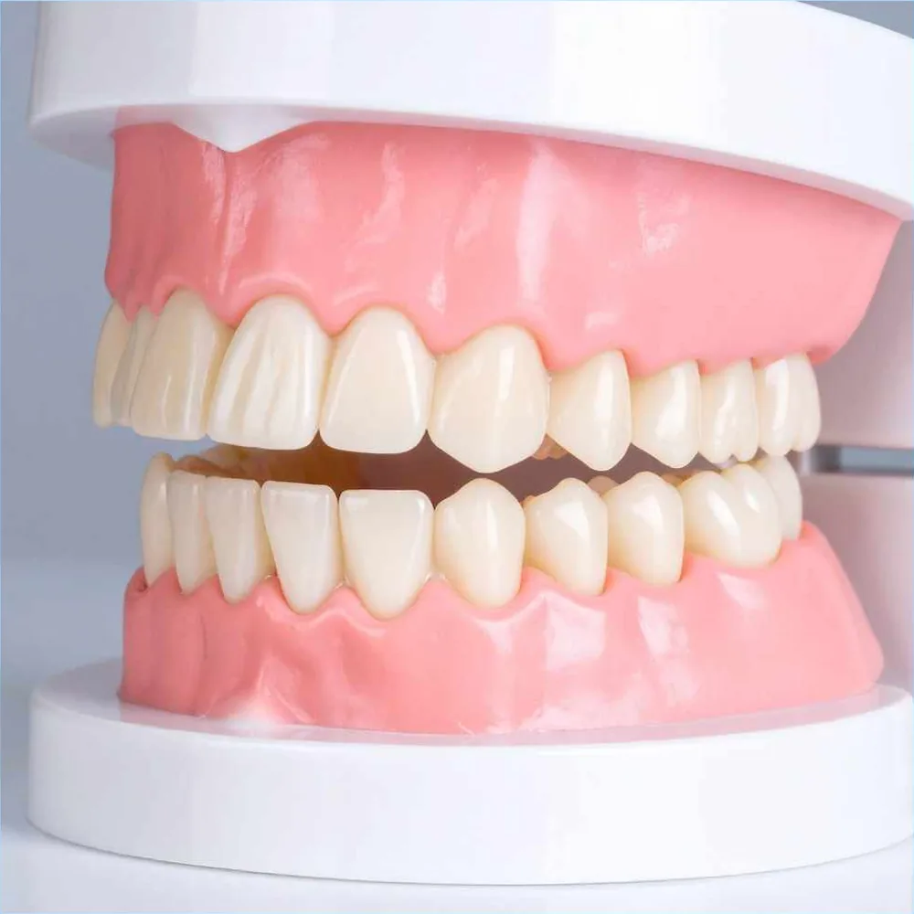 Smile Designing in Frazer Town
