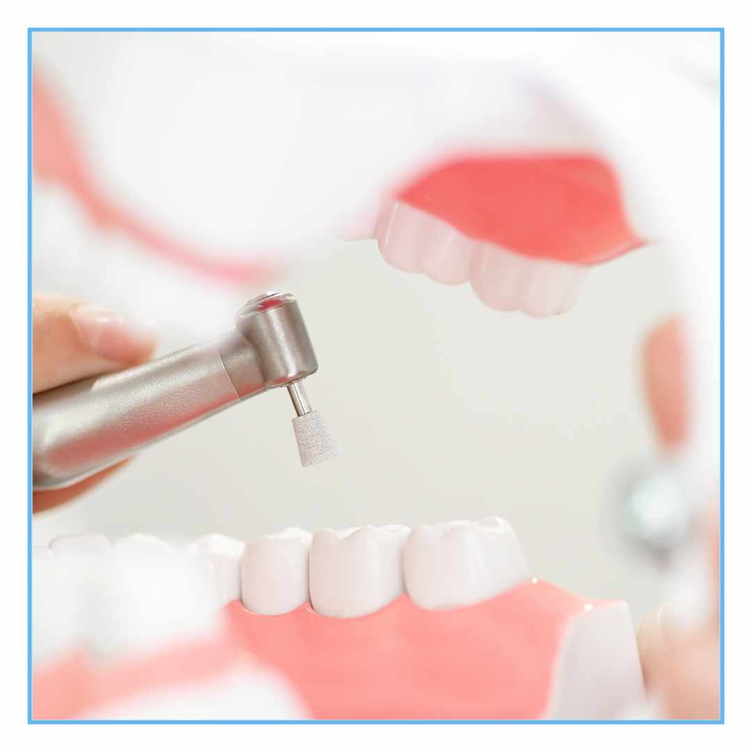 Teeth Cleaning in Frazer Town